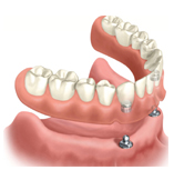 dentures